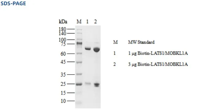 KeyTec® Biotin-LATS1／MOBKL1A, N-Flag-tag-; C-Avi/N-His P1HI0164S
